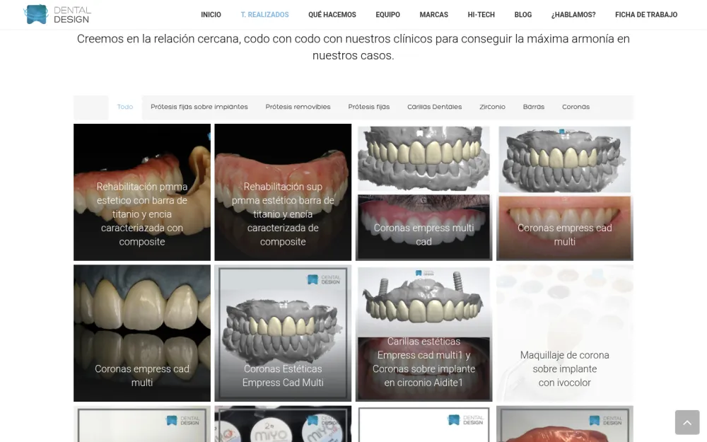 Galería de trabajos de la web de Laboratorio Dental Design